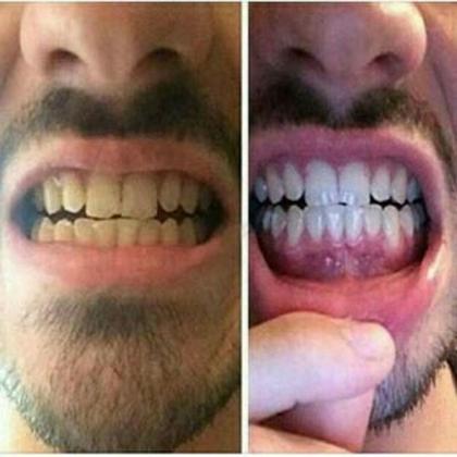 Imagem de White Carvo Mint