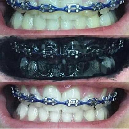 Imagem de White Carvo Mint