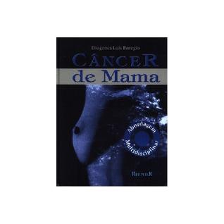 Câncer de Mama