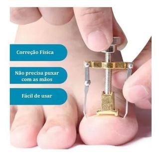Corretor de Unha de Metal para Unhas com Fungos e Curvatura Aparelho de Alinhamento de Pés