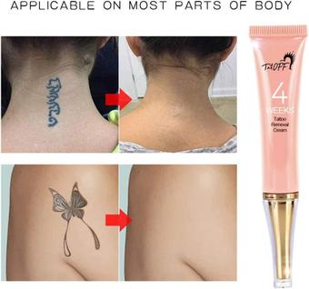 Creme para apagar tatuagem sem laser rápido