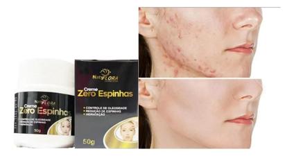 Creme Para Espinhas Rosto 50g