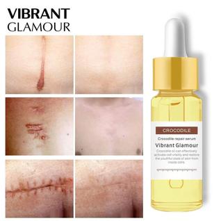 Crocodile Repair Serum Vibrant Glamour Redutor de Cicatriz Hipertrófica Estrias Vermelhas 