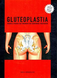 Gluteoplastia passo a passo da cirurgia do contorno posterior