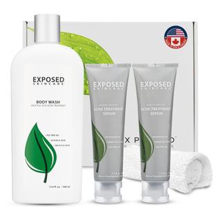 Kit para acne corporal, cuidados com a pele exposta, séruns duplos para acne e sabonete lí