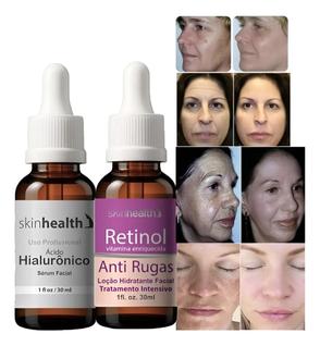 Kit Serum Beleza e juventude com Retinol + Hialurônico 30ml