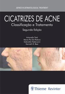 Livro - Cicatrizes de Acne