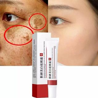 Pomada Creme Clareia Manchas Sardas Melasma eb