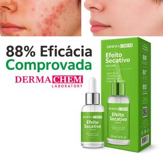 Sérum Secativo de Espinhas e Acnes Niacinamida e Ácido Salicílico Controle de Acne e Oleos
