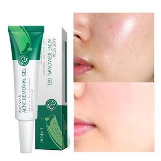 Solução em Gel de Babosa para Rosto com Excesso de Óleo