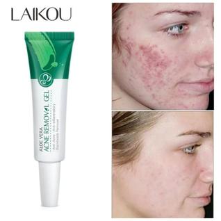 Tratamento de Beleza com Aloe Vera para Rosto sem Viço