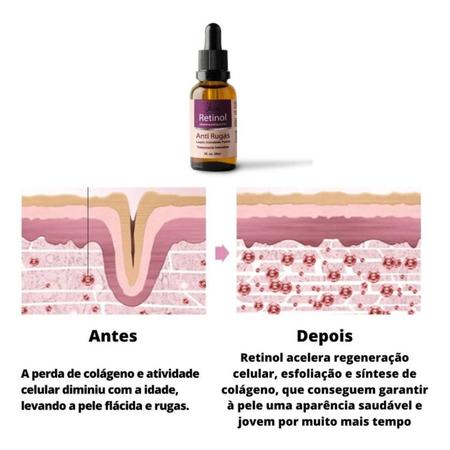 O que é Retinol? Tire suas dúvidas!