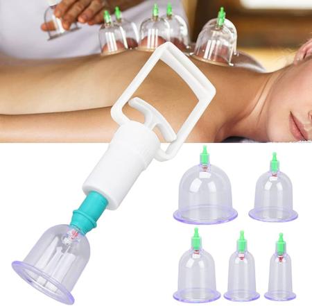 Imagem de 6 Copos Vácuo Terapia Sucção Ventosa Cupping Acupuntura Kit