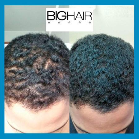 Big Hair Masculino P Trata Capilar Forte Natural Bighair