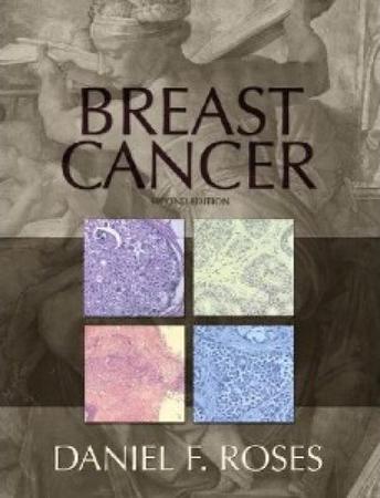 Imagem de Breast cancer - CHURCHILL LIVINGSTONE, INC.