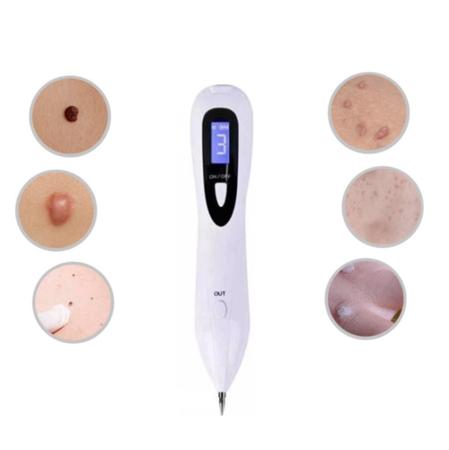 Caneta Despigmentadora Manchas Verrugas Jato De Plasma - Ultra Skin Imagem de Caneta Despigmentadora Manchas Verrugas Jato De Plasma