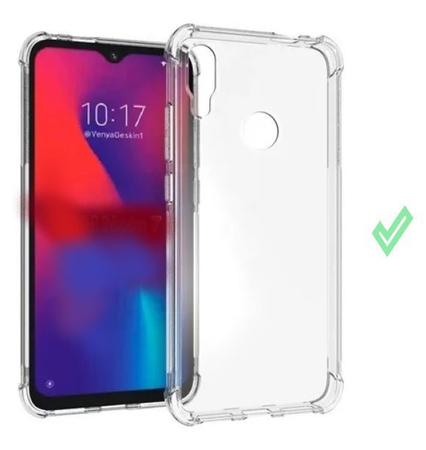 Capa Capinha Case Xiaomi Redmi Note 7 Anti Shock + Película 3D 6D 9D  Blindada Cobre 100% Da Tela Borda Resistente - Yellow Lens - Kit Capinha e  Película para Celular - Magazine Luiza