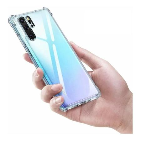 Imagem de Capinha Capa Anti Impacto Huawei P30 Pro