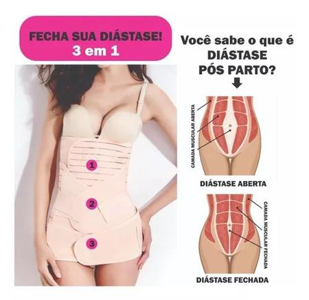 Cinta Pós Cirúrgica Cesariana Diástase Emagrecimento - RecoveryBelt - Cinta  Pós Cirúrgica / Pós Parto - Magazine Luiza