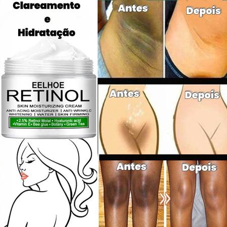 Clareador De Pele Eelhoe Retinol 30ml - Outros Beleza e Perfumaria