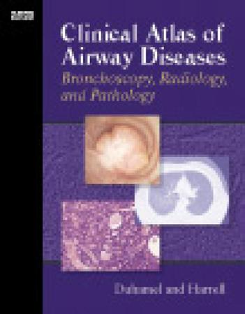 Imagem de Clinical atlas of airway diseases: bronchoscopy, radiology and pathology - ELSEVIER ED