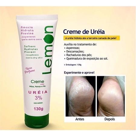 Creme Lemon Para Mãos, Pernas E Pés Ureia 3% 45g - Hidratante para os Pés -  Magazine Luiza