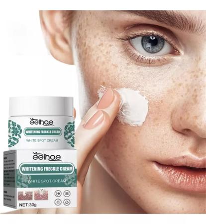 Imagem de Creme Para Remover Tirar Melasma Manchas Sardas Eelhoe