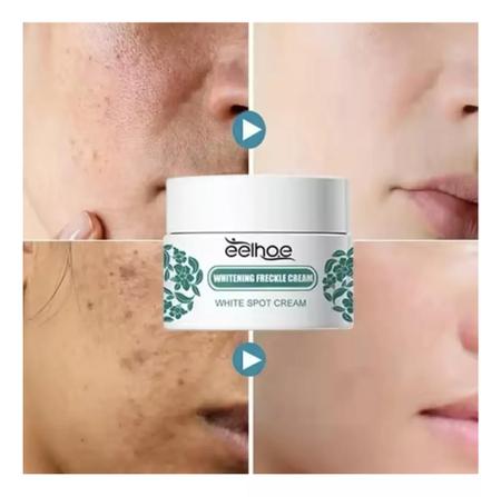 Imagem de Creme Removedor Clareador Melasma Eelhoe 30g.