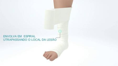 Imagem de Curativo Bandagem Bota de Unna 10,2cm x 9,14m - Casex