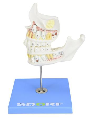 Imagem de Desenvolvimento da Dentição em 4 Etapas