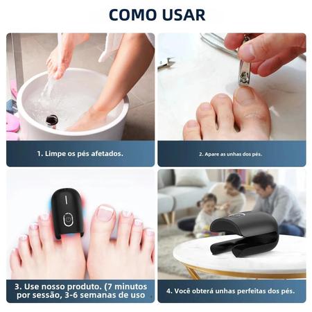 Imagem de Dispositivo Laser Antifúngico para Unhas - 910nm e 407nm - Carga USB