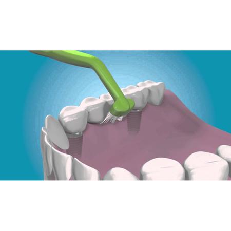 Imagem de Escova Dental Universal Care Tepe Ideal p/ implantes