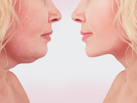 Faixa Afina Rosto Unissex - Fanáticos Por Cintas Imagem de Faixa Afina Rosto Unissex