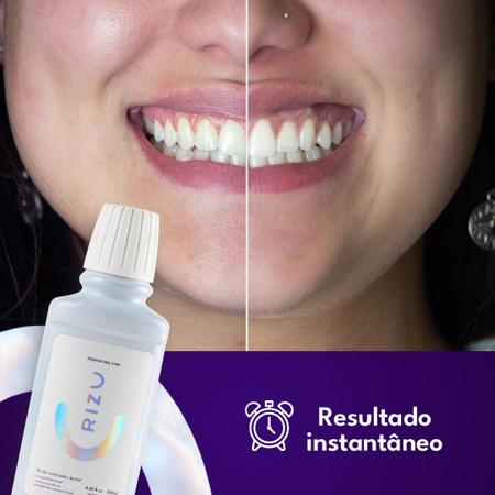 Matizador dental: será que ele, de fato, funciona? - ELLE Brasil