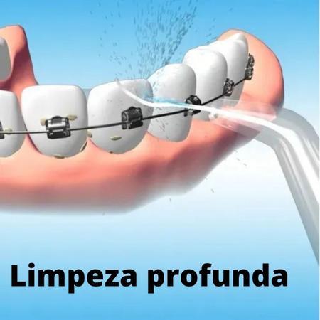 Irrigador Bucal Limpador de Dentes Gengiva - Cemtech Imagem de Irrigador Bucal Limpador de Dentes Gengiva