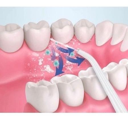 Imagem de Irrigador Oral Elétrico Jato Dágua Limpador Dental E Bucal