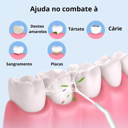 Imagem de Irrigador Oral Elétrico Portatil Jato Água Limpador Dentário Bucal