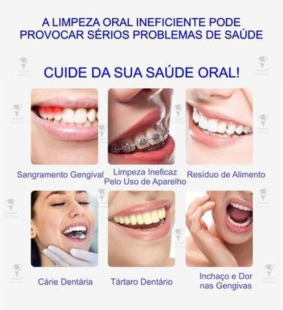 Imagem de Irrigador Oral Portátil Higienizador Higiene Dentes Gengival