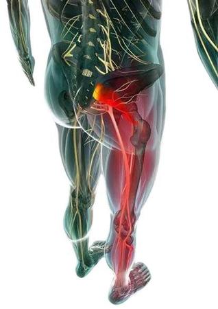 Imagem de Joelheira Ortopédica Magnética para Artrose Inflamação Joelhos e Ciático