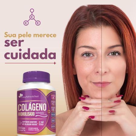 Imagem de Kit 03 Colágeno Hidrolisado Verisol + Associações 120