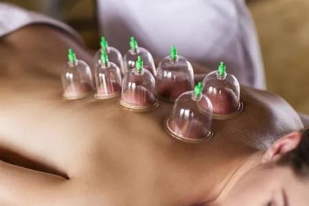 Imagem de Kit 12 Ventosas Corporal Terapeuticas Ventosaterapia Copos Massoterapia Cupping Acupuntura Sucção