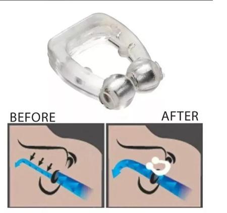 Imagem de Kit 2 Clip Nasal Anti Ronco Magnético Com Imã Apneia Nariz
