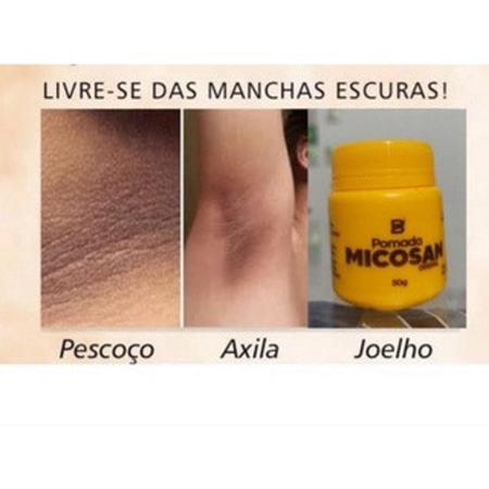 Kit completo micosan Clareador De Manchas Virilha Axilas Espinhas Micosan -  Cosméticos Sexuais - Magazine Luiza