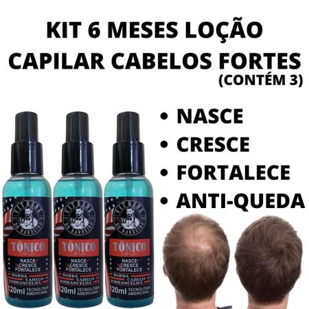 Imagem de Kit 3 Tônicos Liquido Em Spray Nasce Cresce E Trata Alopecia