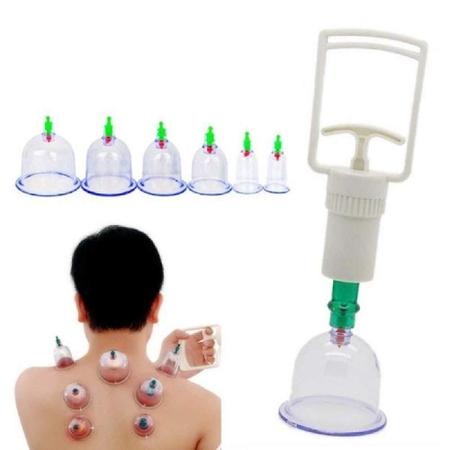 Kit Ventosas Com Bomba Ventosaterapia 6 Copos - Makeda Imagem de Kit Ventosas Com Bomba Ventosaterapia 6 Copos