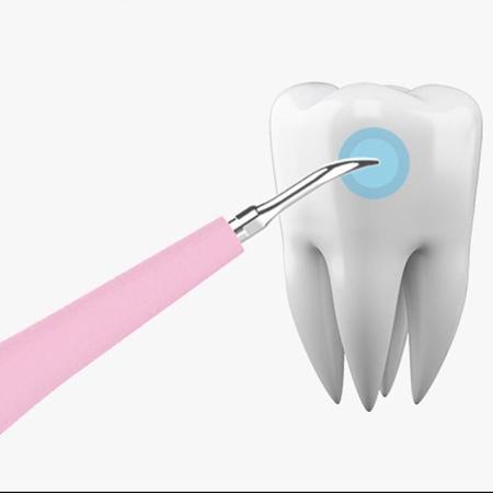 Imagem de Limpador de dentes ultra-sônico (tamanho único)