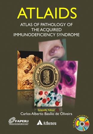 Imagem de Livro - ATLAIDS - Atlas of pathology of the acquired immunodeficiency syndrome