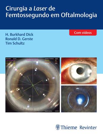 Imagem de Livro - Cirurgia a Laser de Femtossegundo em Oftalmologia