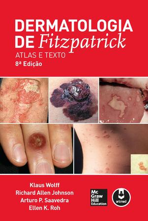 Imagem de Livro - Dermatologia de Fitzpatrick