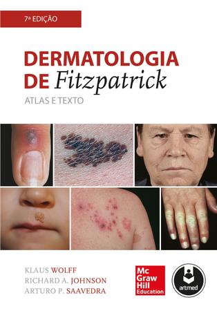 Imagem de Livro - Dermatologia de Fitzpatrick